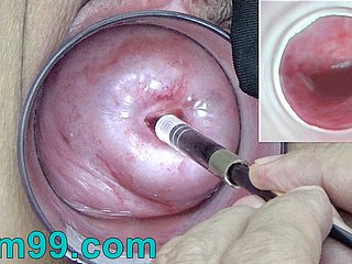 The grippe cámara endoscopio japonés dentro del cuello uterino en dispirit vagina Cam